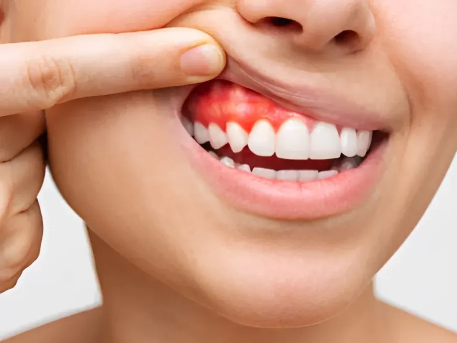 Periodontia